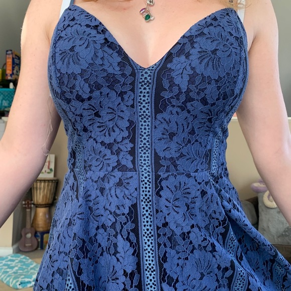 Blue Lace Dress - Picture 2 of 14